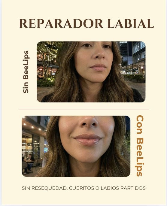 Kit Abeja Reina Crema Hidratante + BeeLips