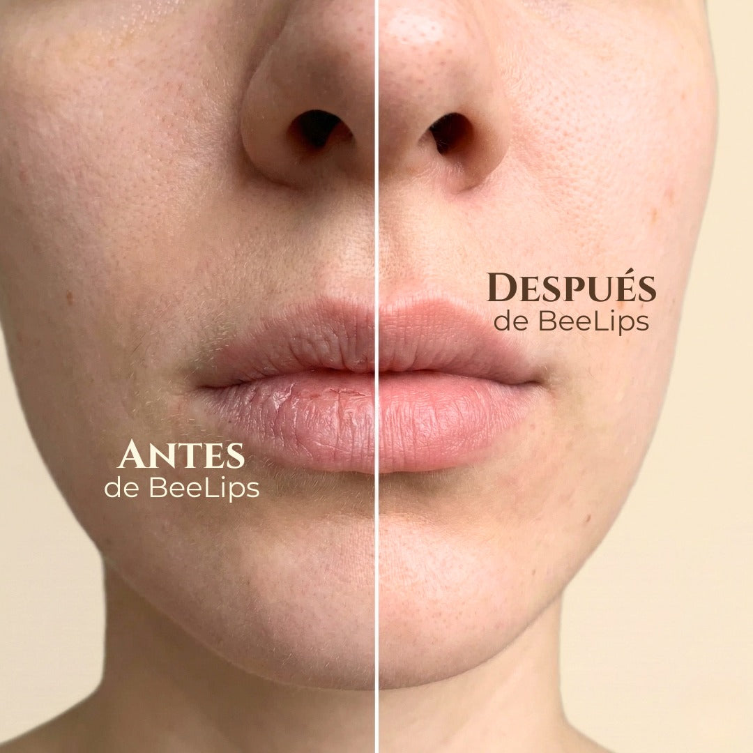 Antes y después de usar BeeLips