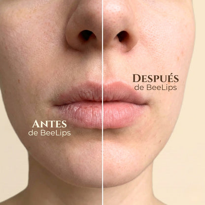 Antes y después de usar BeeLips